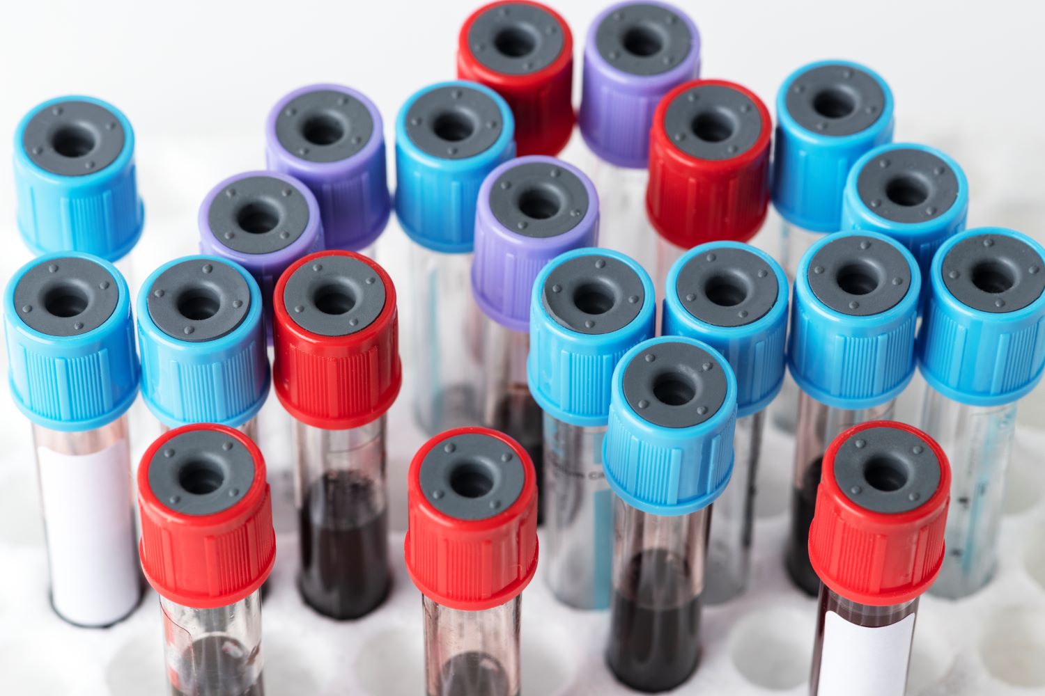 blood-samples-in-test-tube-rack (1)