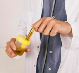 doctor-s-hands-holding-an-urine-test-scaled