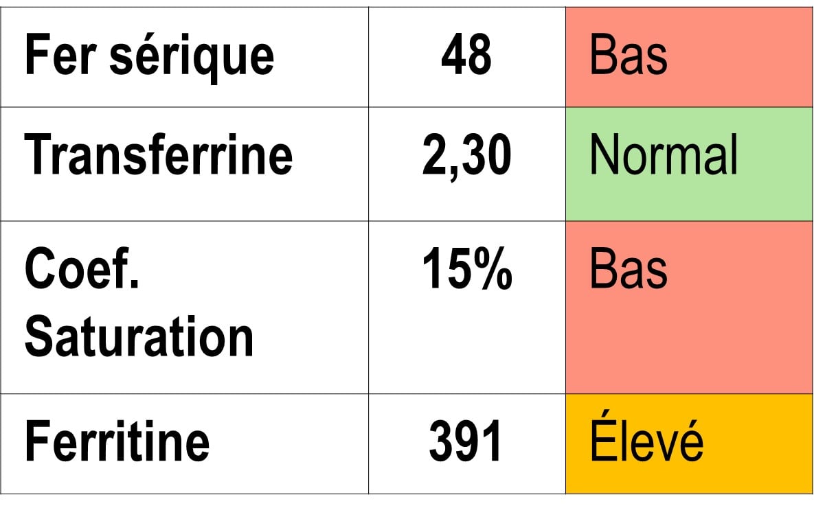 FER_Illustration_Carence fonctionnelle