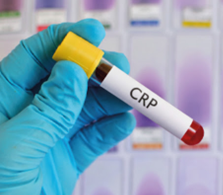 CRP_maruque de reference de l'inflammation aigue